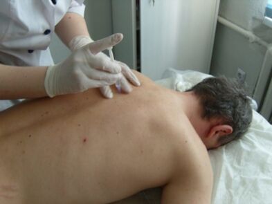 Injeções intra-articulares de condroprotetores para osteocondrose torácica